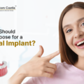 Whom Should You Choose for a Dental Implant? 