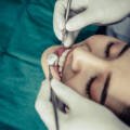 Dental Implants in Valsad